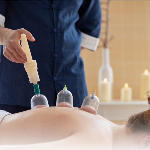 Ventosaterapia foto dunamis pilates